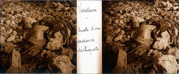 Iconographie - Verdun - Buste d'un cadavre déchiqueté